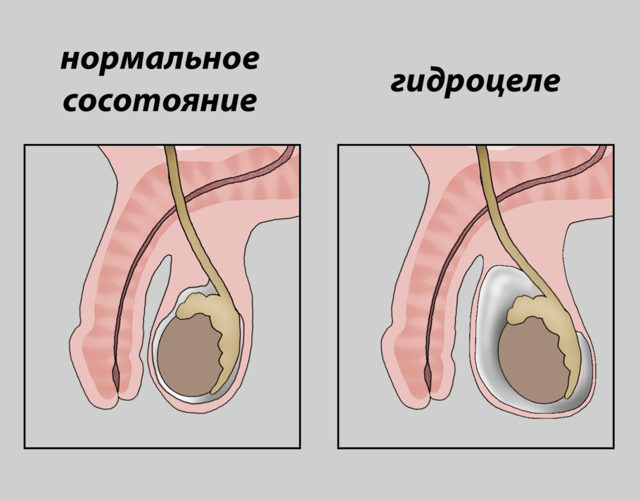 9 болезней яичек у мужчин и детей: описание, симптомы и лечение