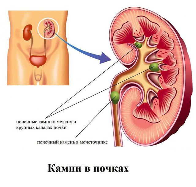 Кровь в сперме у мужчин: причины и лечение, что это означает?