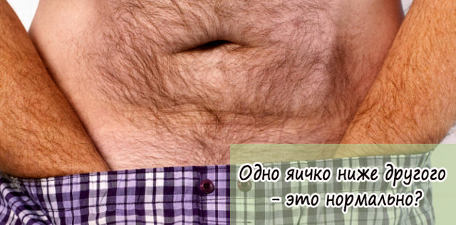 Одно яичко ниже другого у мужчин: почему и что делать?