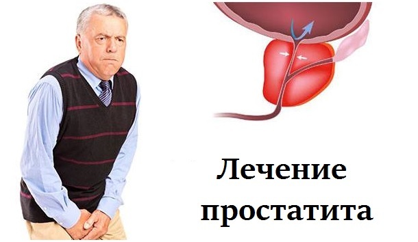 Березовый деготь от простатита: лечение (рецепты и применение), отзывы