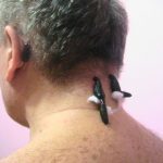 Пиявки для повышения потенции у мужчин: куда ставить на член?
