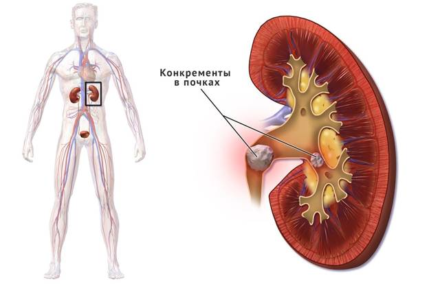 Простатит и потенция мужчин: влияние и лечение импотенции