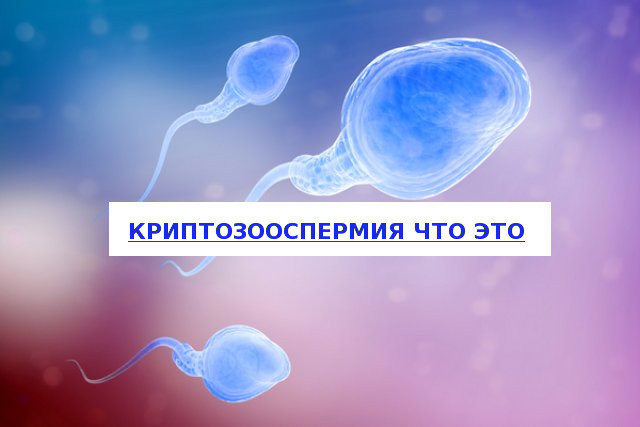 Криптозооспермия у мужчин: причины, симптомы, лечение