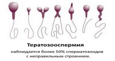10 советов как 100% улучшить качество спермы у мужчин (+ препараты)