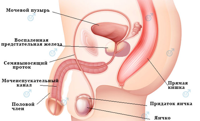 Простатит и потенция мужчин: влияние и лечение импотенции