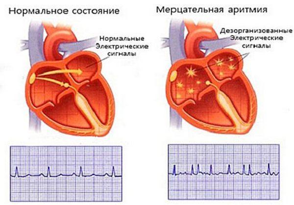 Таблетки Виагра для мужчин: инструкция по применению, цена, отзывы