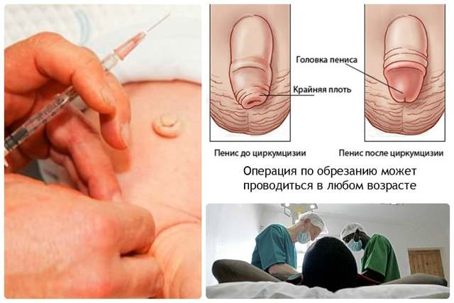 Чувствительность полового члена: как повысить и снизить?