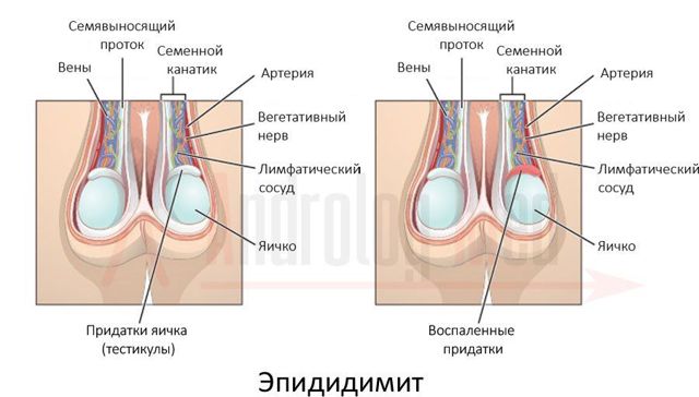 Кровь в сперме у мужчин: причины и лечение, что это означает?