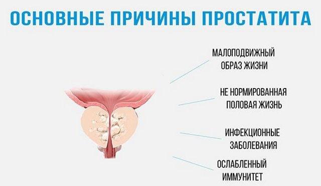 16 народных средств от простатита у мужчин: самые эффективные для лечения рецепты и способы, отзывы