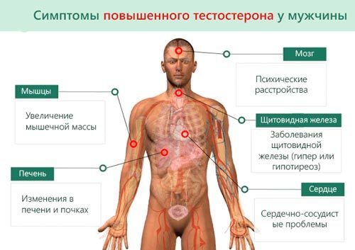 Повышенный тестостерон у мужчин: причины, признаки, последствия